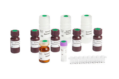 Rapid Test Male Fertility Test Kit For Evaluating Male Epididymis Secretory Function